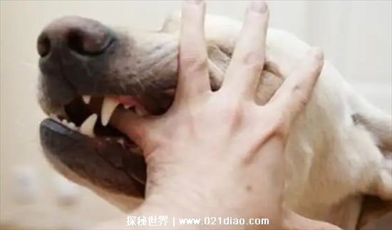 狂犬疫苗多少钱一针?