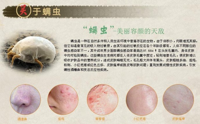 床上螨虫咬的症状图片