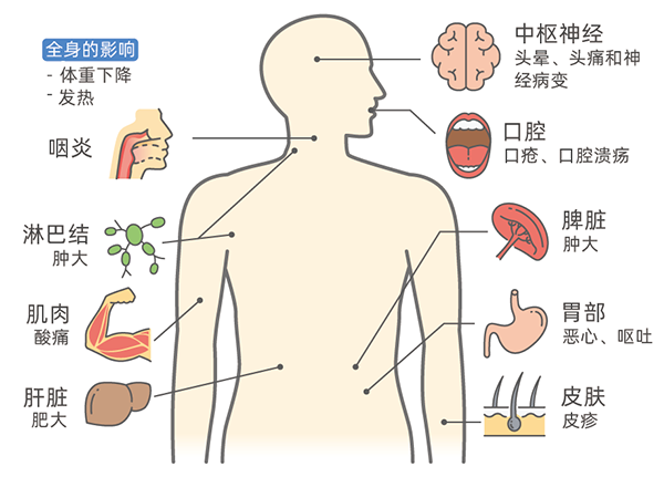 全球已有5名艾滋病患者被治愈，距离终结艾滋病还有多远？