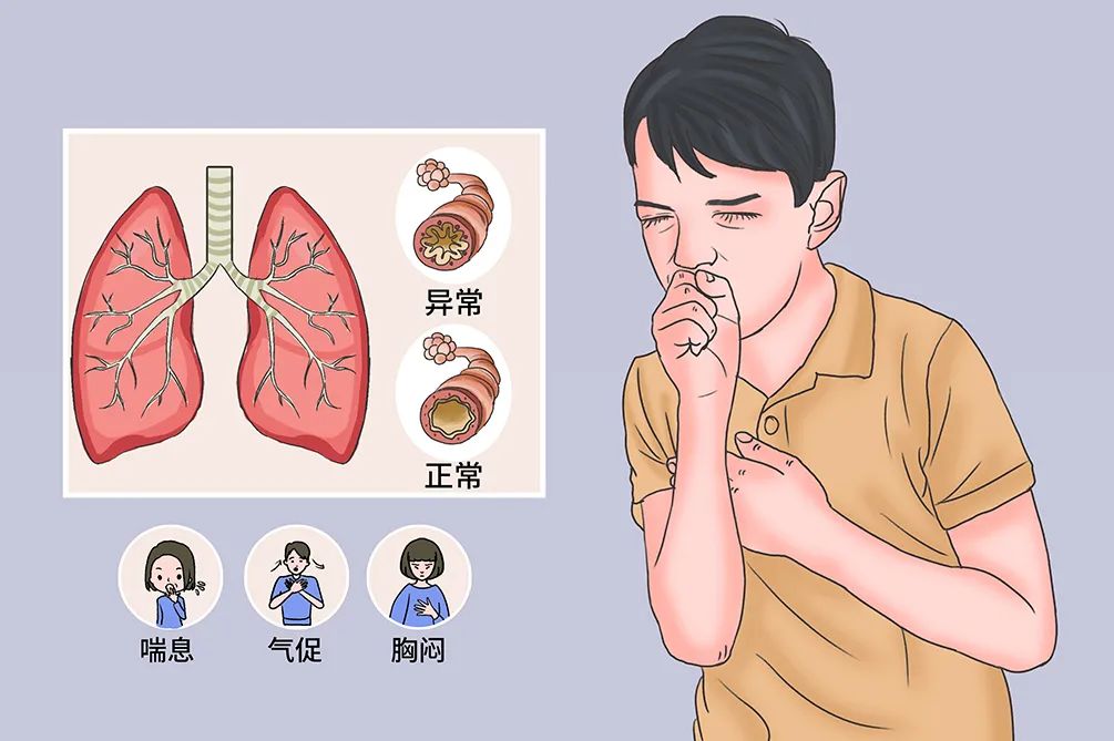 春季抗敏指南
