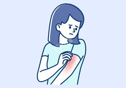 春季抗敏指南