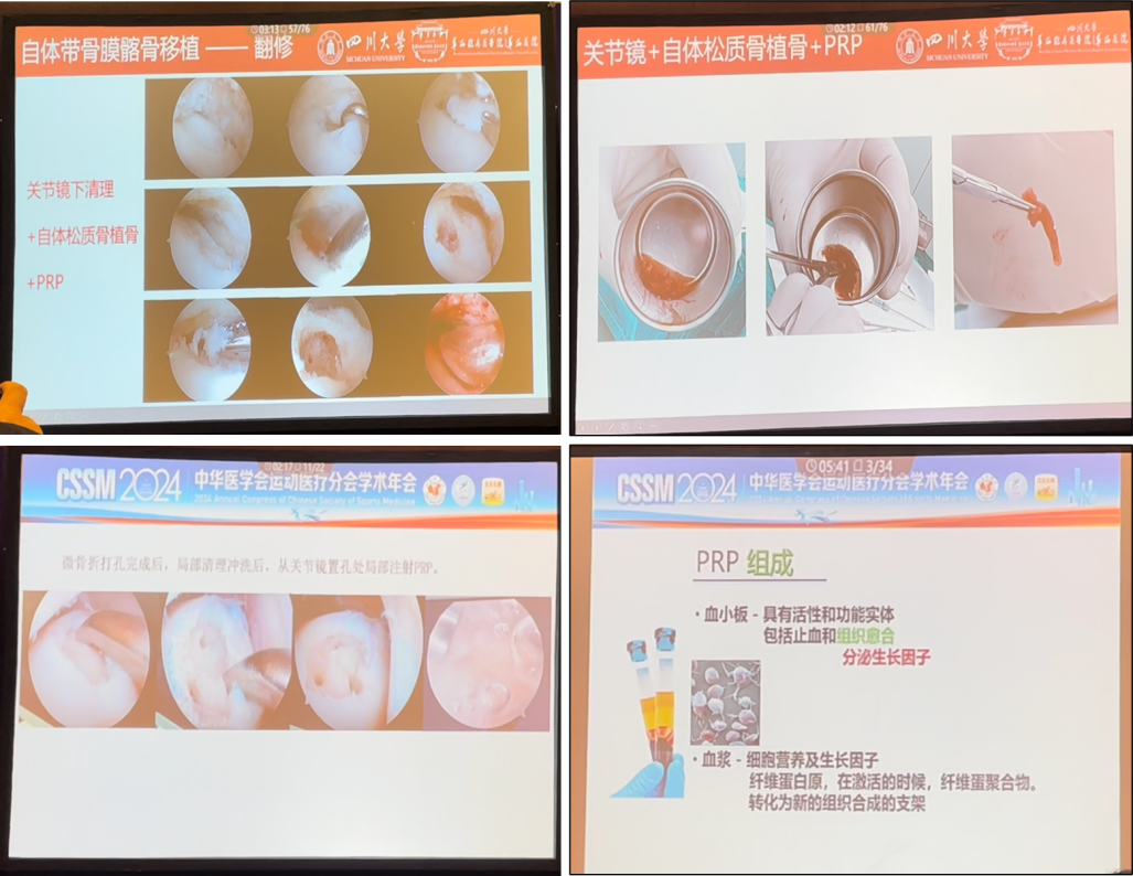 2024 CSSM｜华熙生物助力运动医学创新发展