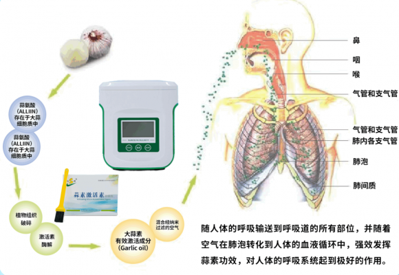 甲流势头汹汹，蒜素呼吸治疗仪出奇制胜，以蒜入肺传承国医精髓