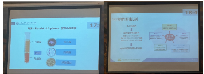 中国医师协会2024年疼痛科医师年会——聚焦PRP在疼痛治疗中的创新应用
