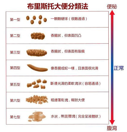 曲靖哪家肛肠医院好？肛肠健康五步自测，轻松了解肛肠状况