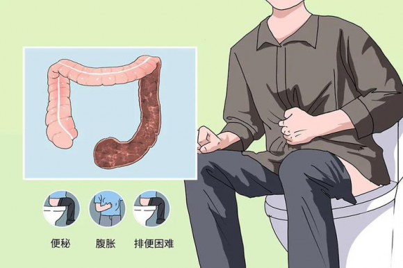 贵阳微创胃肠专科医院：减肥减出“结肠黑变病”，肠镜检查发现肠子变黑，严不严重？