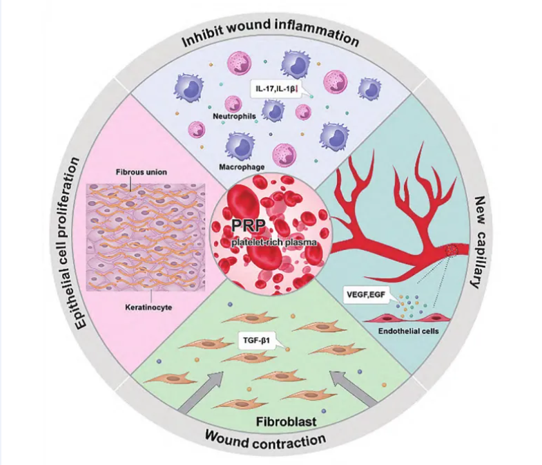 拒绝“美丽陷阱”,PRP才是循证可依的再生医学正解