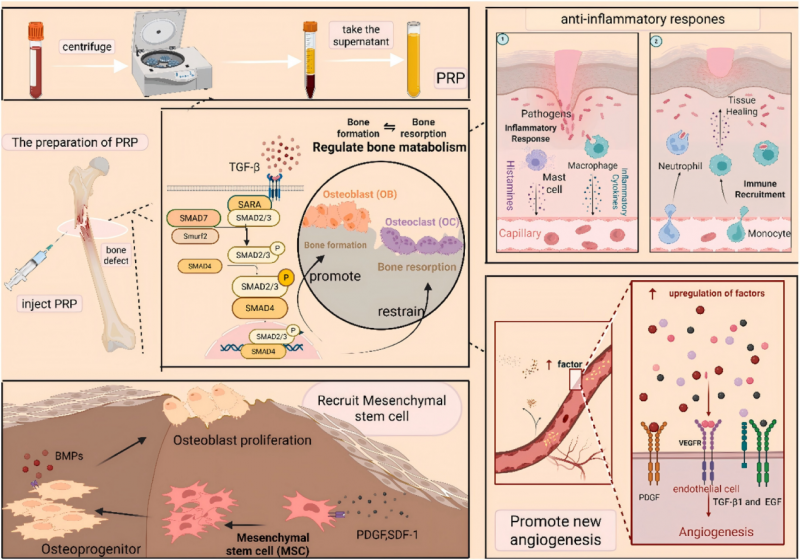 PRP疗法:骨损伤修复的新希望!